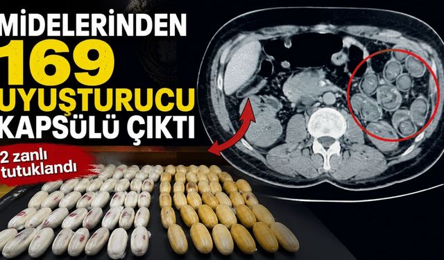 Midelerinden 169 Uyuşturucu Kapsülü Çıktı