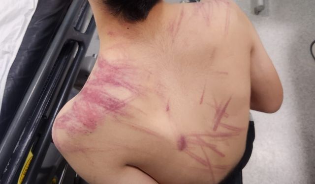 Rehabilitasyon merkezinde darp iddiası: Valilik "hafif yaralandı" dedi, aile darp izlerini paylaştı