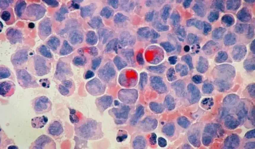 Google’ın yapay zekasından kanser tedavisinde dev adım