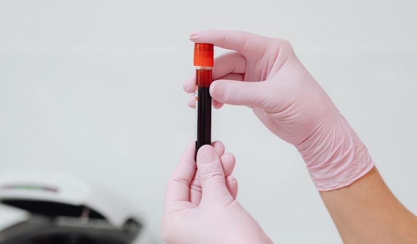 FO2HB Değeri Düşüklüğü Nedir?