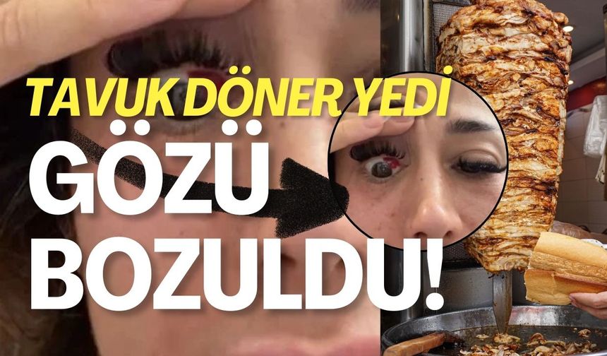 Tavuk Döner Yedi Gözü Bozuldu!