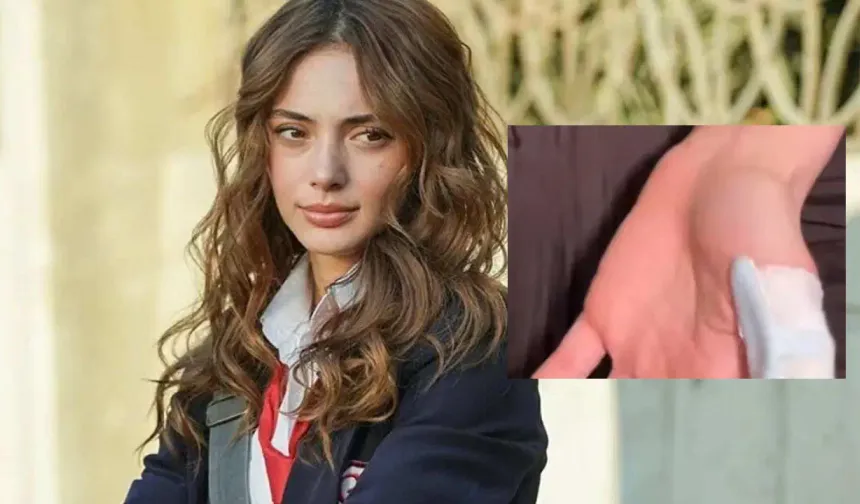 Teşkilat Setinde Kaza: Rabia Soytürk Yaralandı