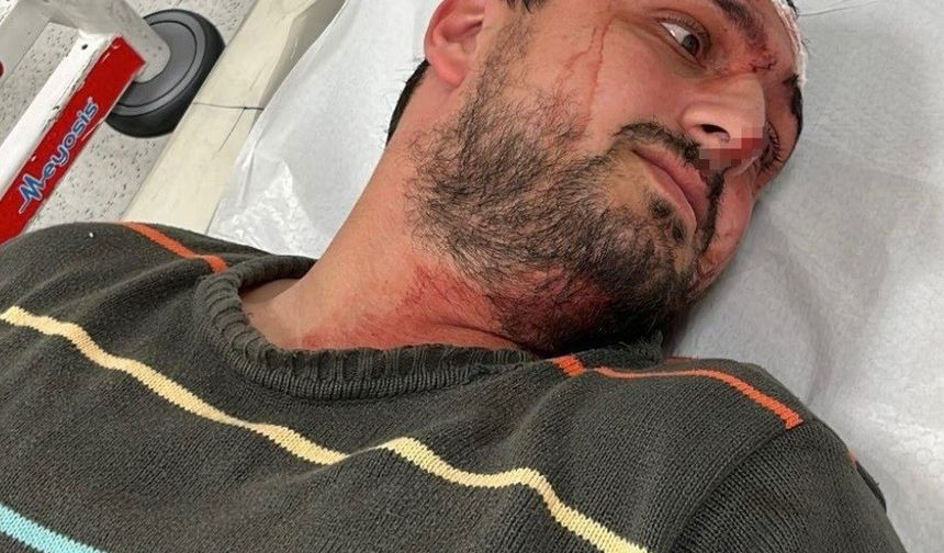 Otizmli Genci Odunla Dövmüştü İlk Duruşması Görüldü