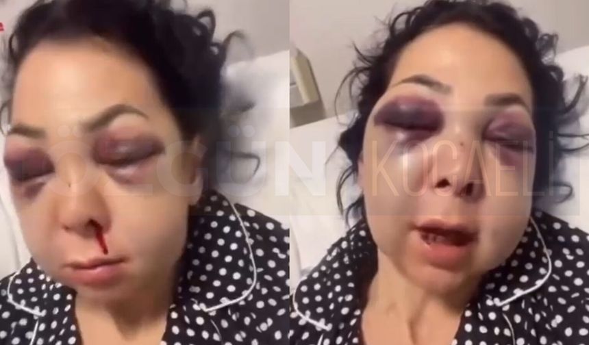 İzmit’te Dehşet: Anne Oğul Mekanda Topluca Darbedildi