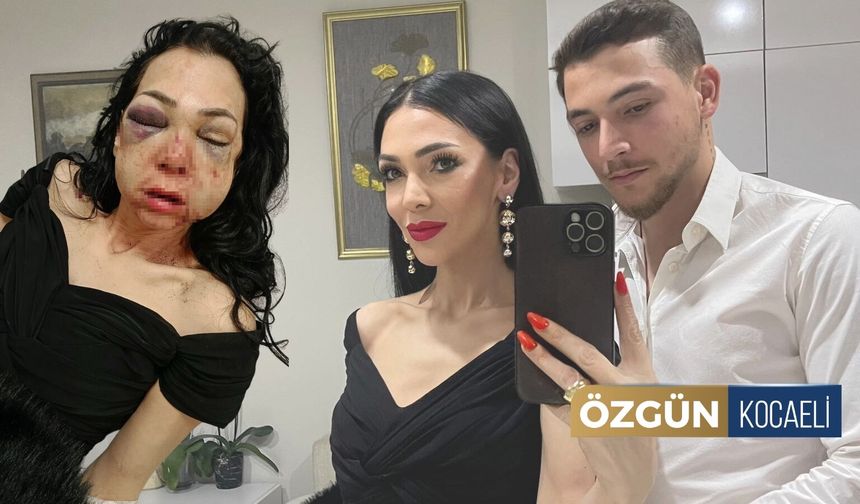 İzmit'te Anne Oğulu Tanınmayacak Hale Getirenler Yakalandı