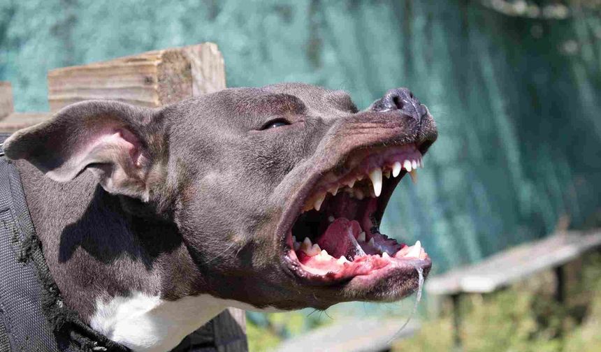 Ünlü Şarkıcıyı Pitbull Parçaladı