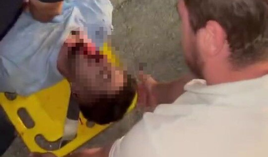 Kocaeli'de Motor Faciası! Kanlar İçinde Yerde Kaldı