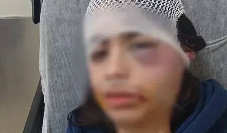 Yeşim Öztürk'ü Öldüresiye Döven Erkek Arkadaşının Tahliye Talebi Reddedildi