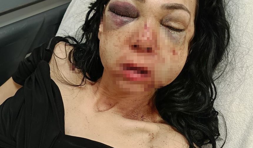 İzmit'te Dövülen Anne Oğulun Davası Görüldü