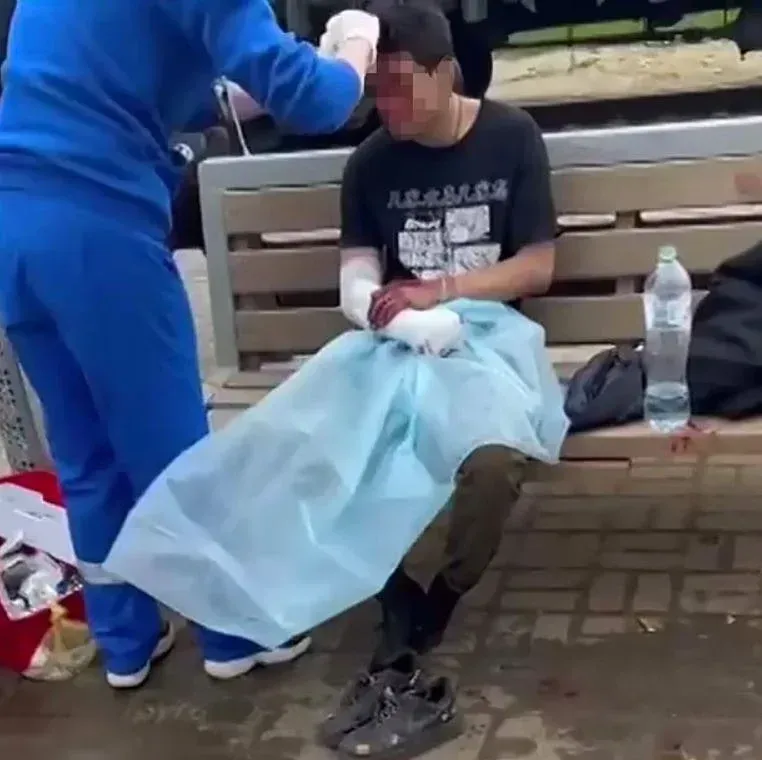 TikTok çekerken penisini yaktı