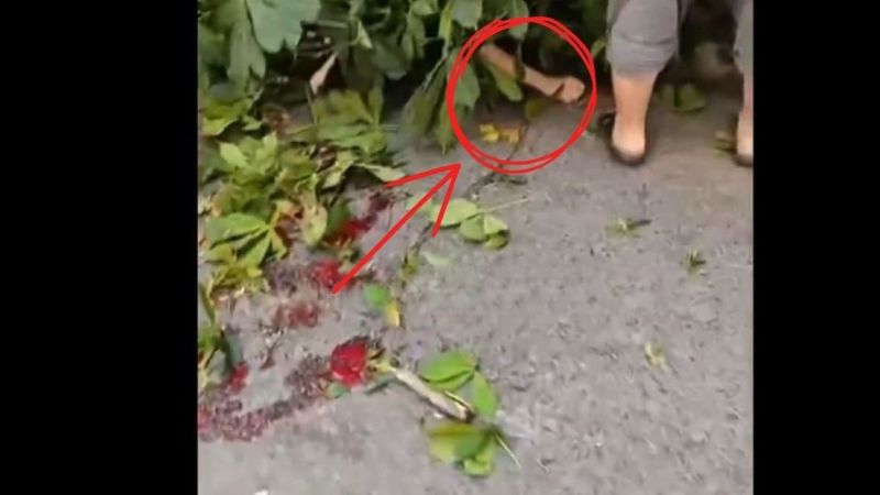 Ünlü oyuncu devrilen ağacın altında kaldı! Durumu kritik