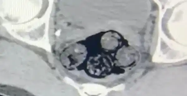 2694650D Da11 4626 Ada0 78B3197Ea124