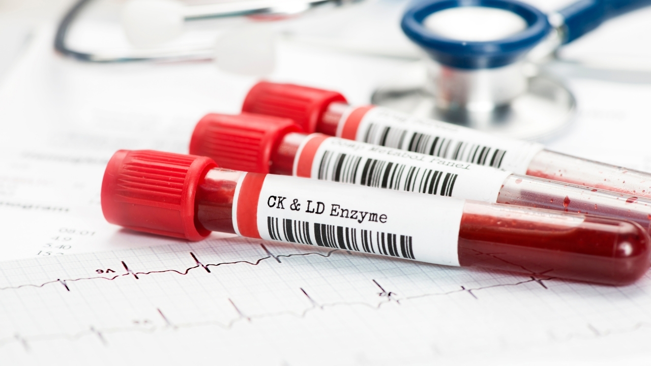 F O2 H B Degeri Dusuklugu