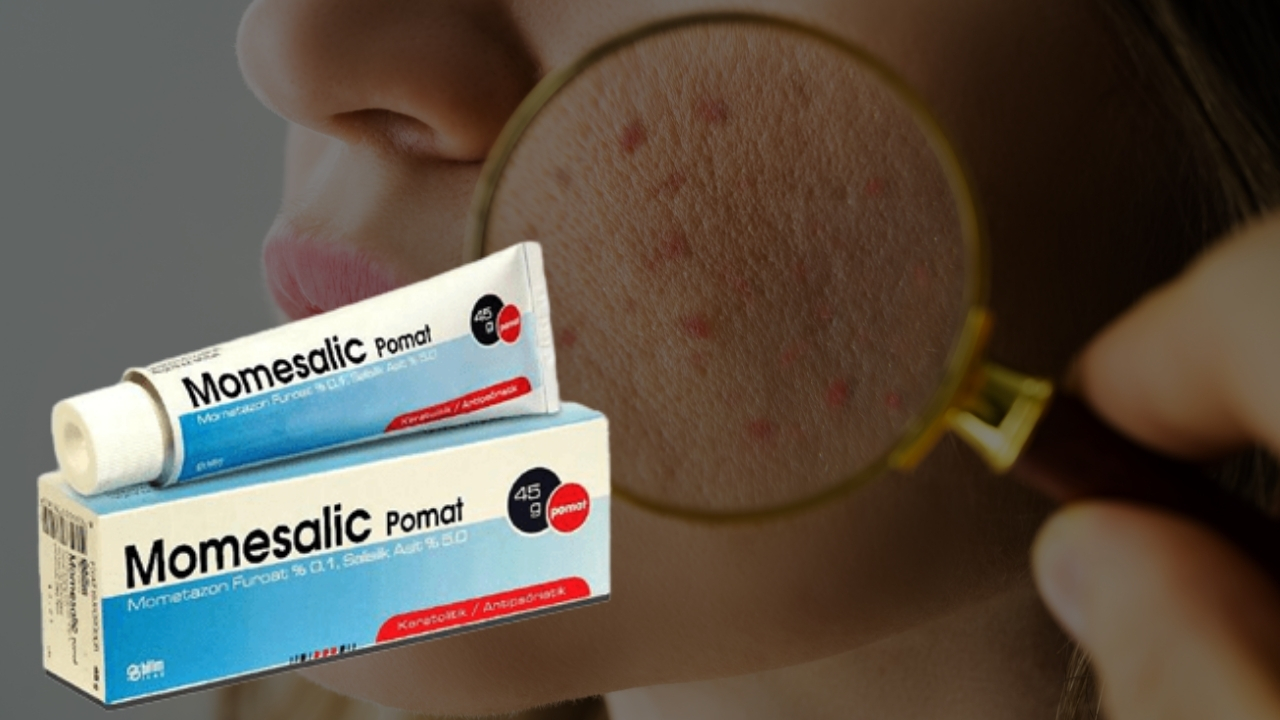 Momesalic Krem Neye Yarar