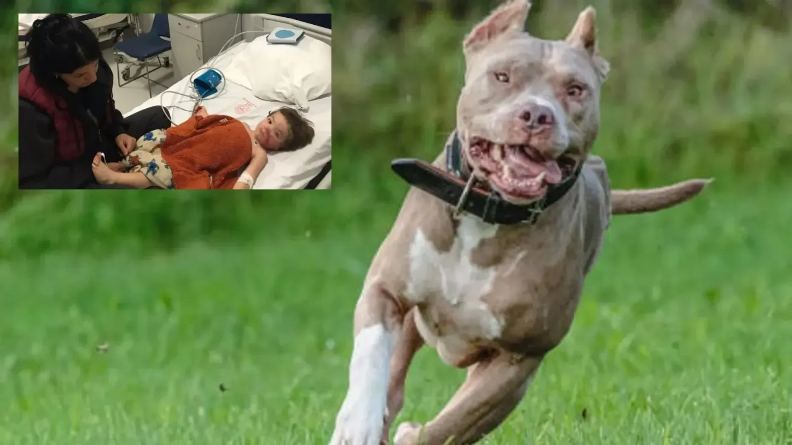 Ankarada 15 Ve 5 Yasindaki Iki Kardese Pitbull Saldirisi Kopegin Sahibi Tutuklandi4Wwwcagdaskocaelicom