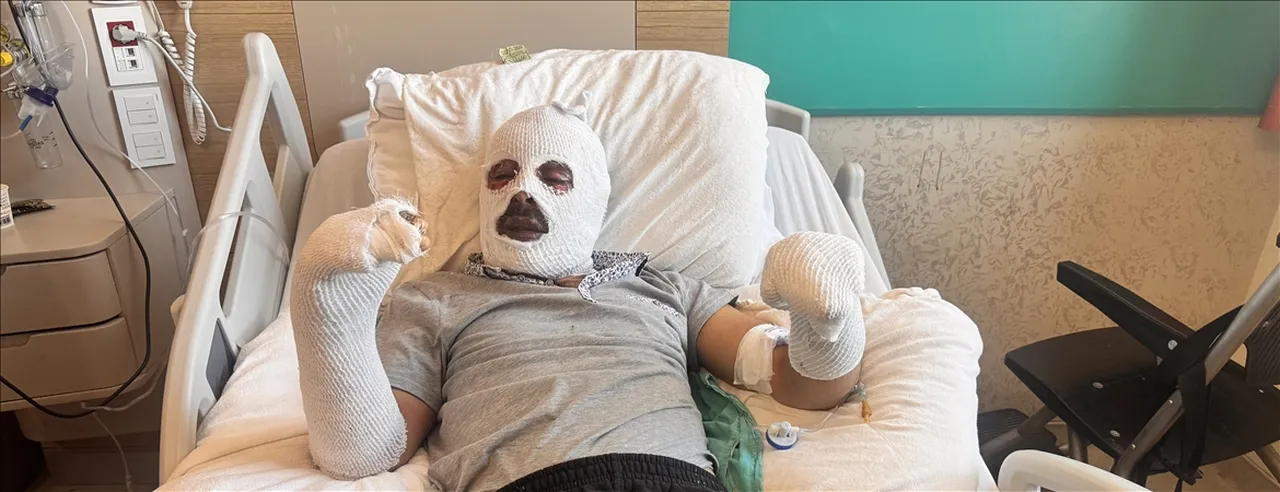 Cay Demlerken Vucudunun Yuzde 26Si Yandi Ev Ustume Yikildi 1756824 202512191352 20251219135250 1