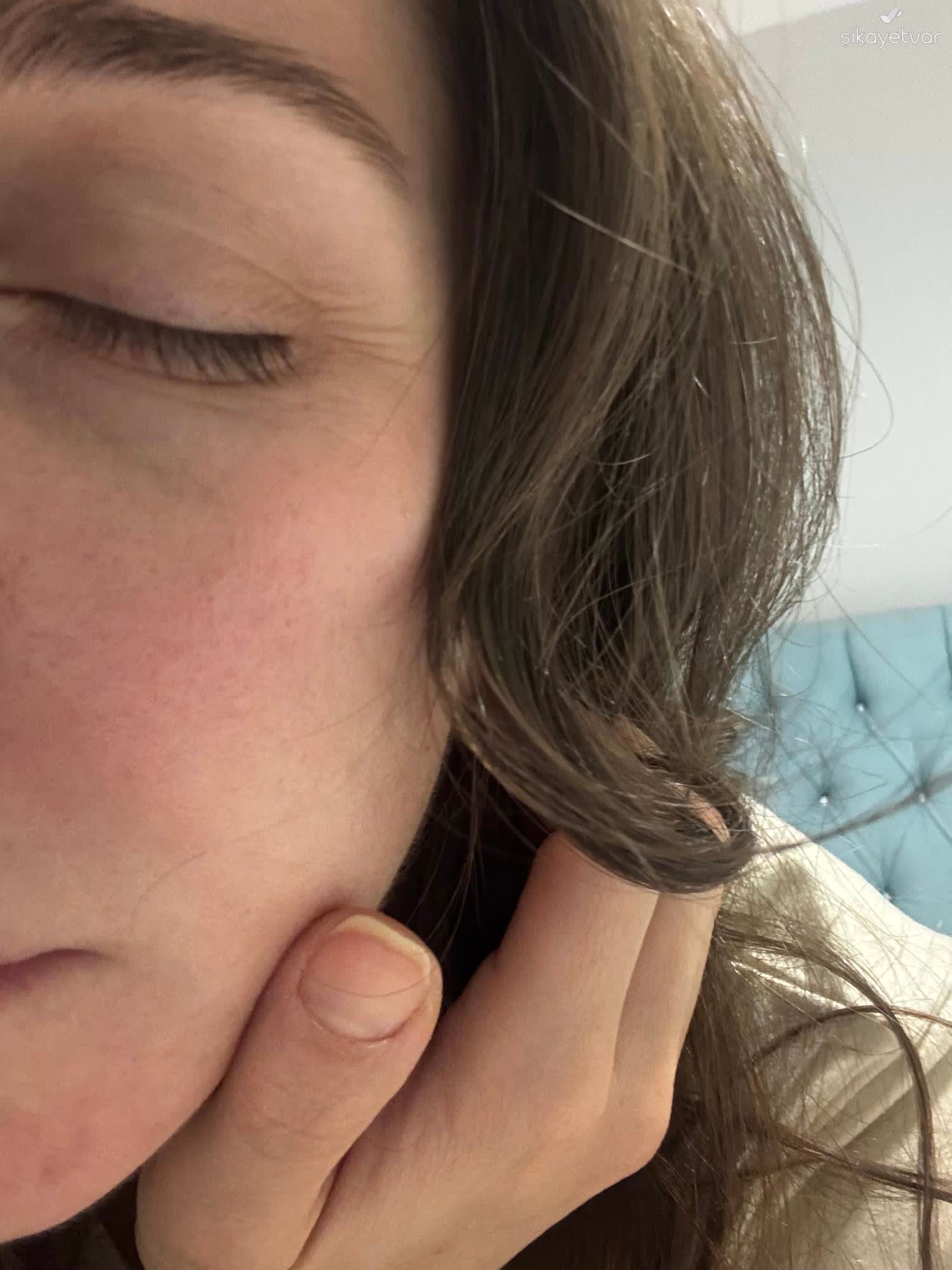 Nivea Jel Krem Cildimde Siddetli Yanma Ve Tahrise Sebep Oldu 2