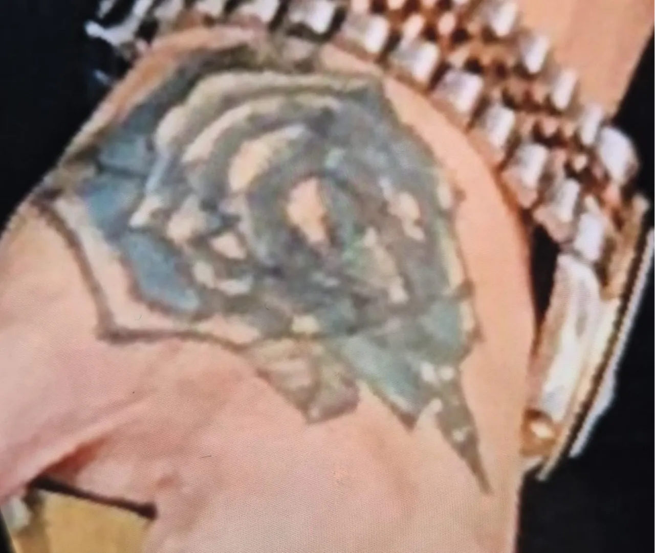 Guzellik Merkezi Faciasi Dovmesini Sildirmek Istedi Simdi Doku Nakli Gundemde 1761071 202601051857 20260105185748 1