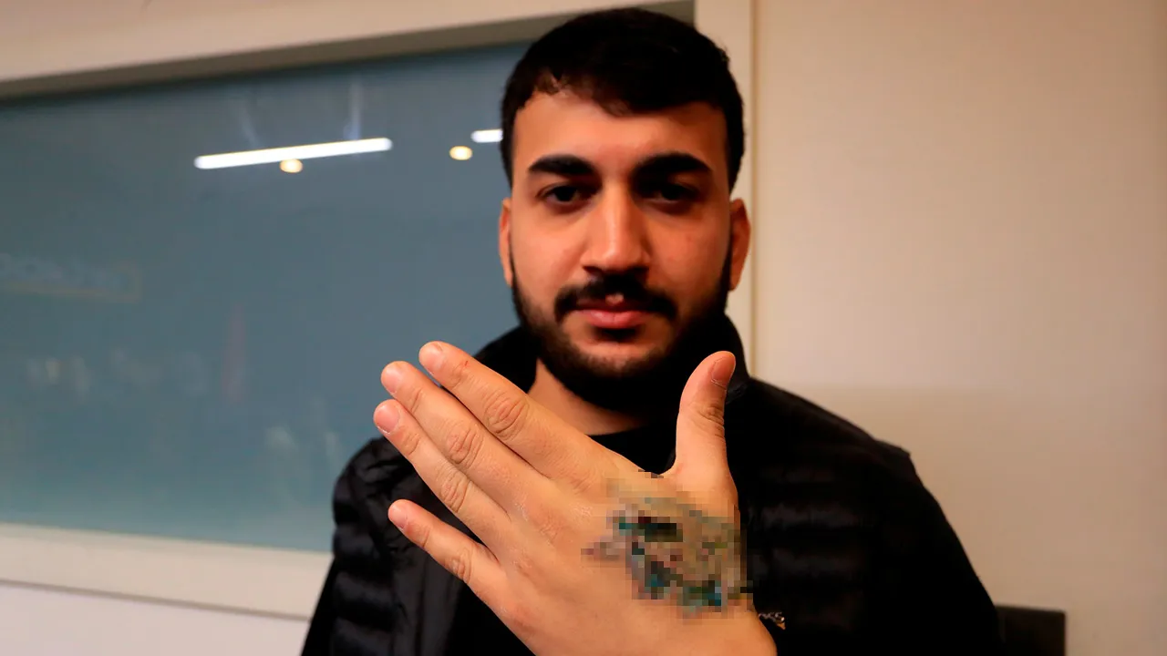 Guzellik Merkezi Faciasi Dovmesini Sildirmek Istedi Simdi Doku Nakli Gundemde 1761071 202601051857 20260105185748 2