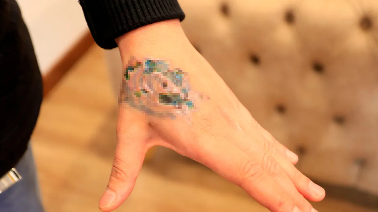 Guzellik Merkezi Faciasi Dovmesini Sildirmek Istedi Simdi Doku Nakli Gundemde 1761071 202601051857 20260105185748 3