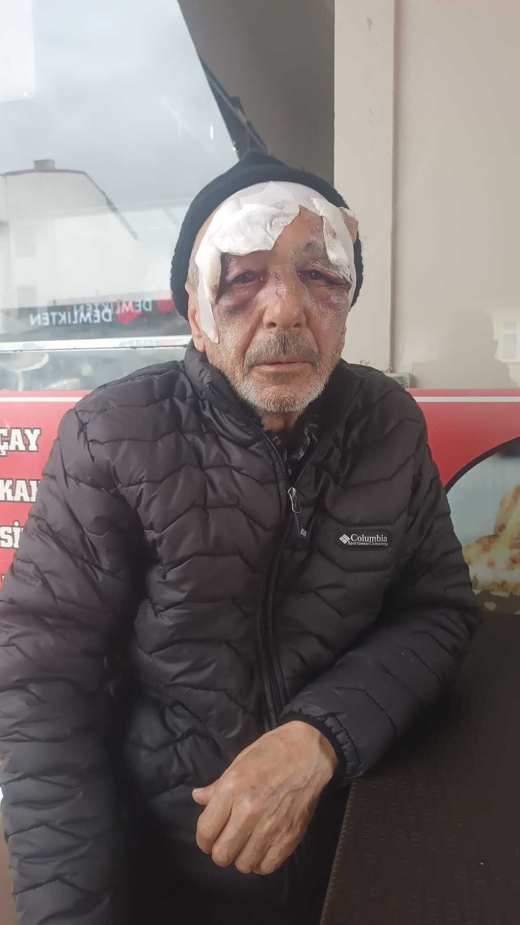 Darp Edilen Amca 1771242607