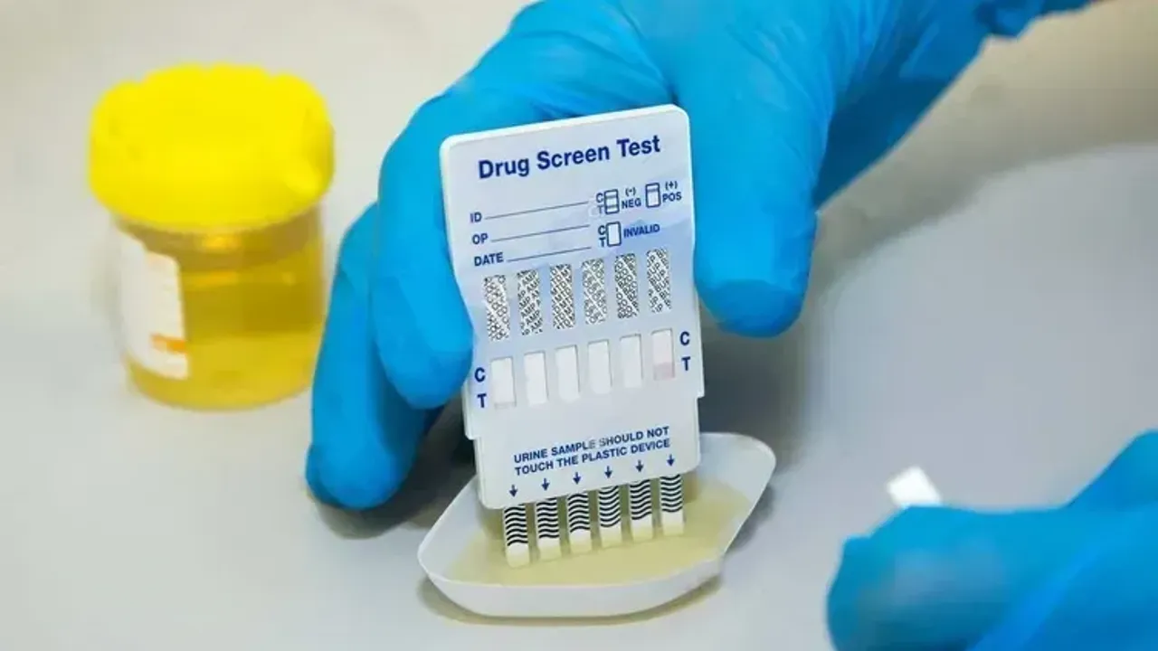 Ise Alimlarda Uyusturucu Testi Uygulamasi 2026