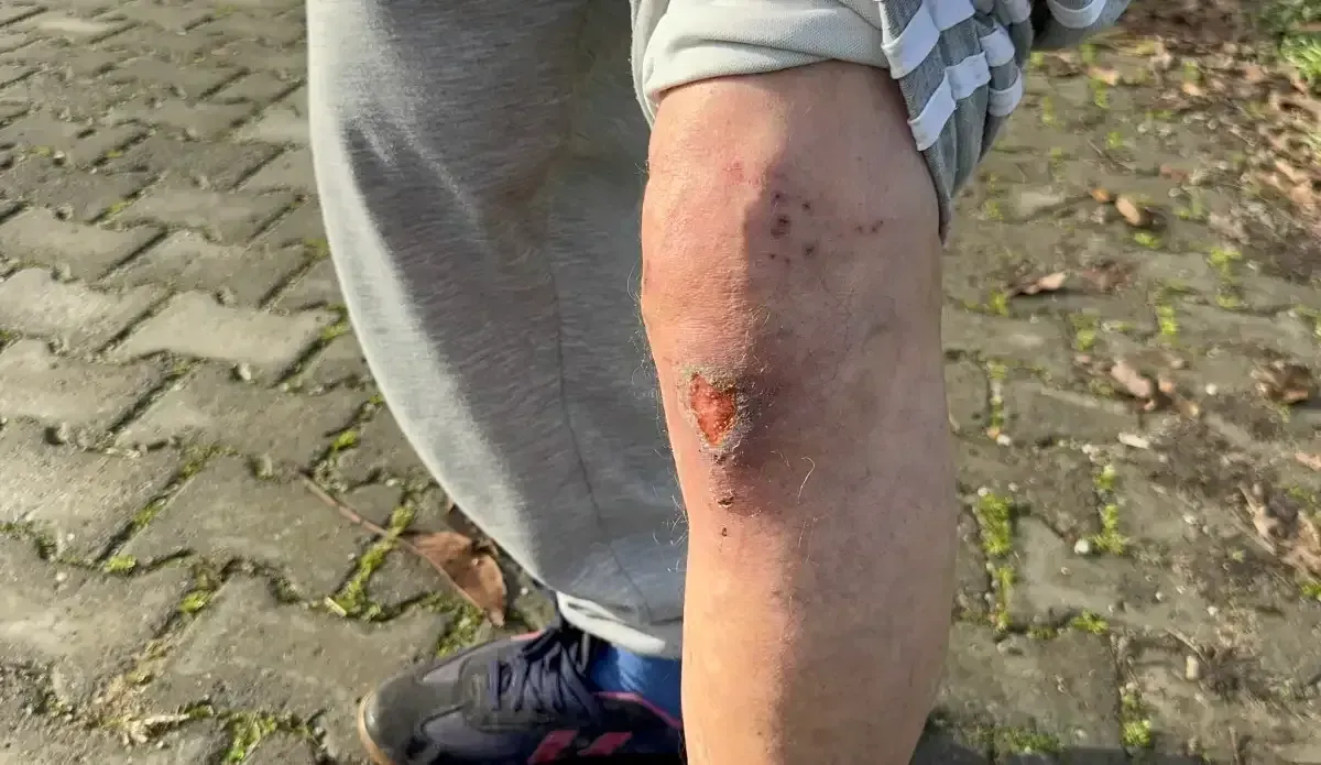 Sokak Ortasinda 1 Kiloluk Altini Gasp Edildi Kocaeligundem 4