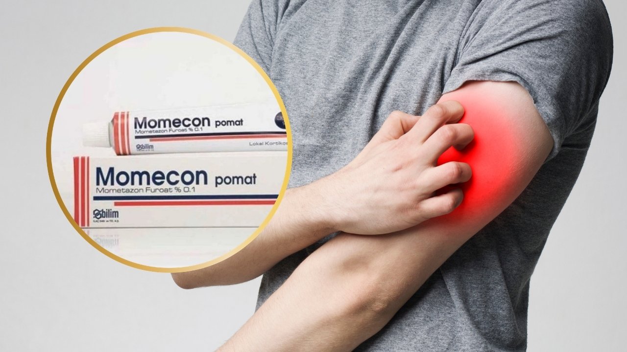 Momecon Krem Nedir