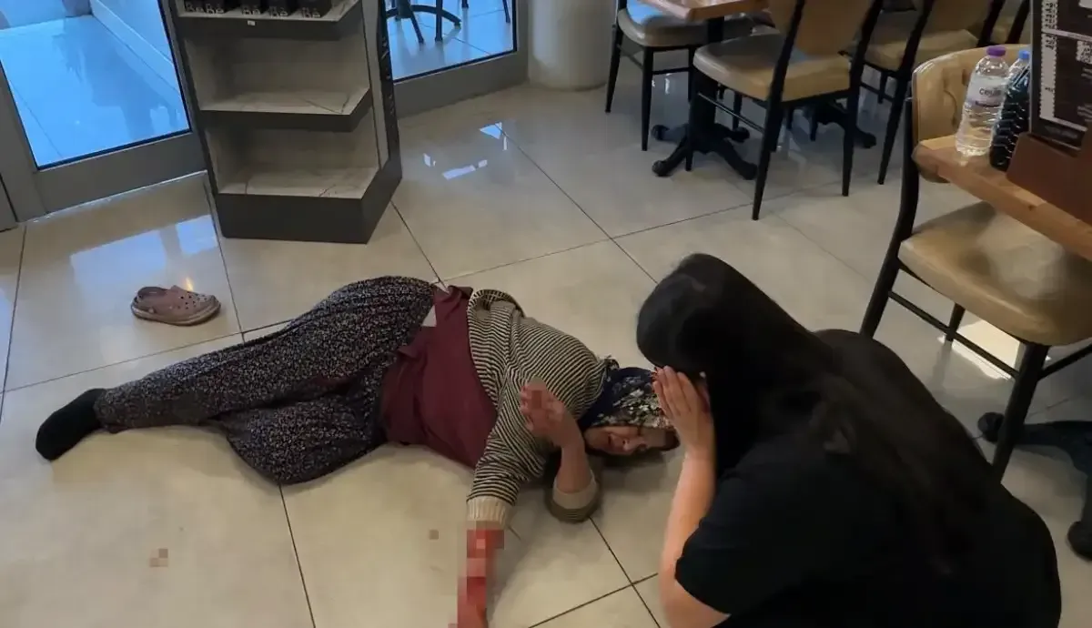 Dinlenme Tesisinde Kopek Dehseti Kadinin Kolu Koparildi 5