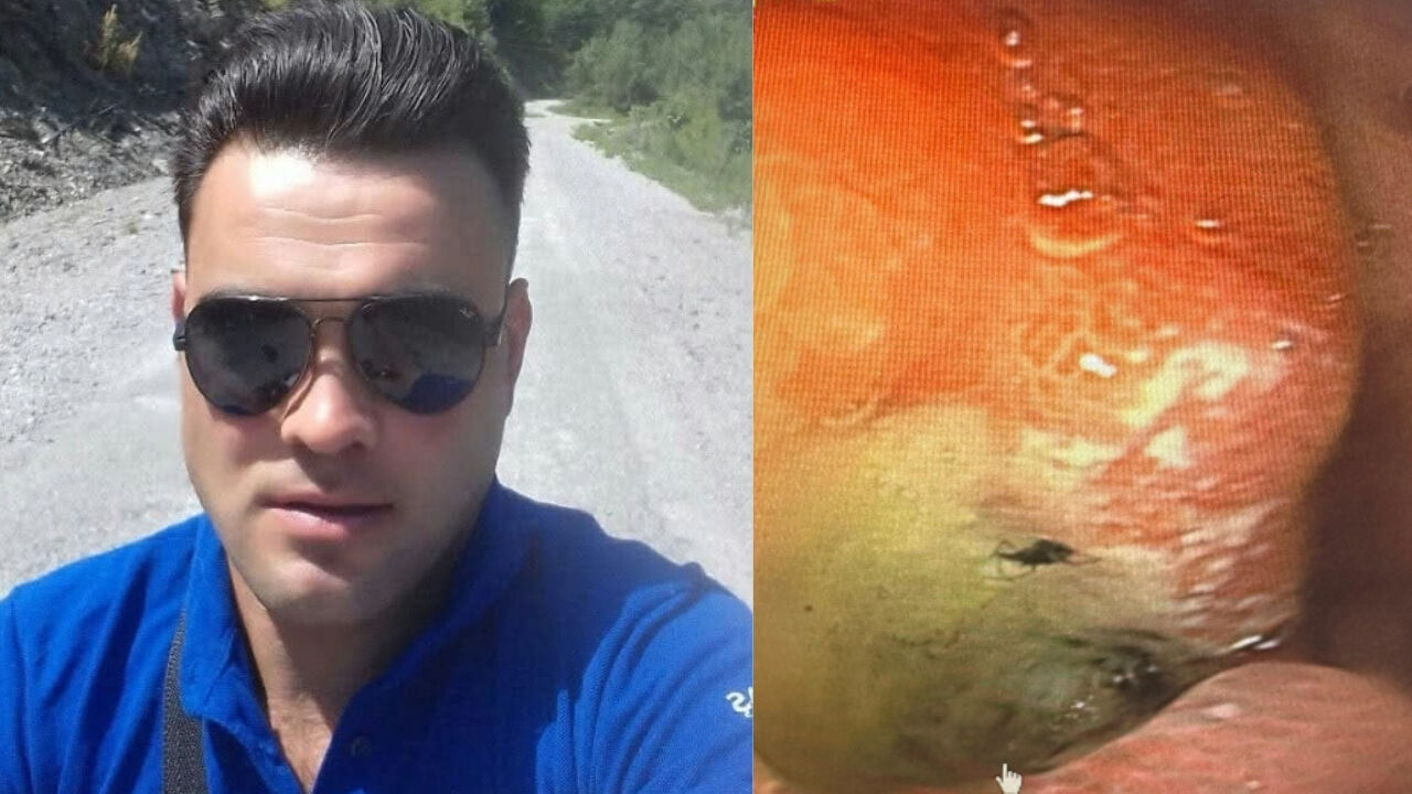 Midesinden Canlı Böcek Çıkarıldı (1)